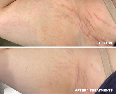 vipeel body soho nyc